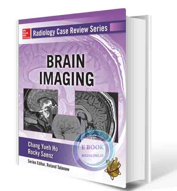 دانلود کتاب Radiology Case Review Series: Brain Imaging 1st (ORIGINAL PDF)